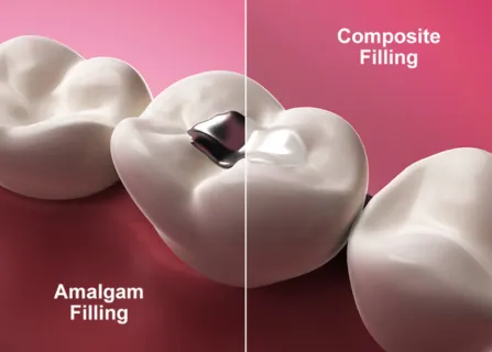 Image related to gentle technique & careful isolation