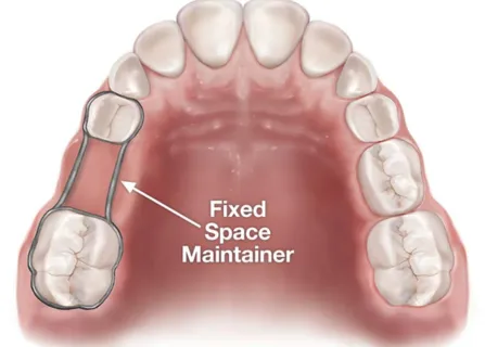 Image related to custom-fitted for your child