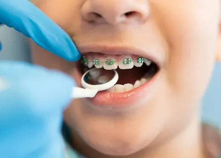Image related to harmful oral habits