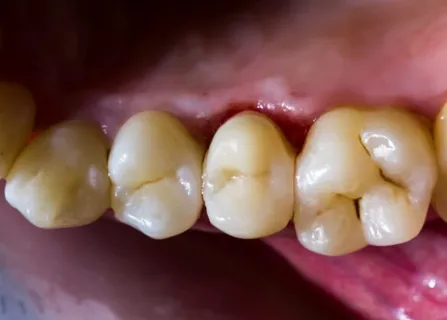 Image related to before & after guidance (what to expect)