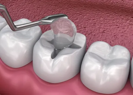 Image related to clear parent guidance after treatment